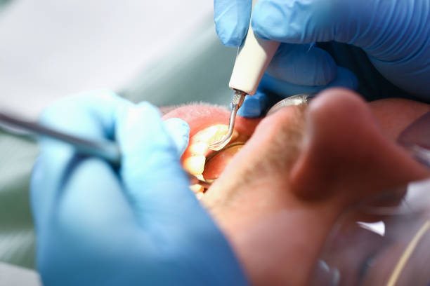 Best Tooth Infection Emergency Dentist  in Belleview, FL